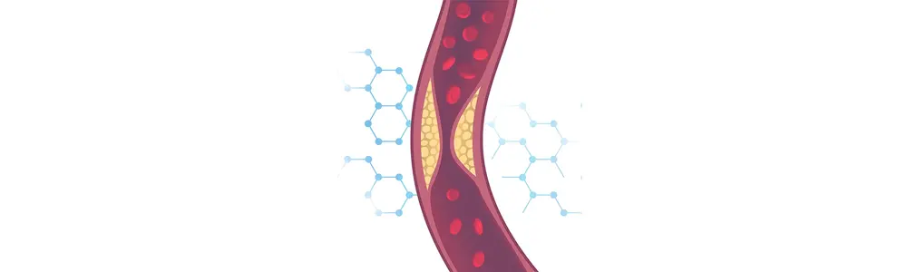 Cholesterol Too High? Five Things Proven to Help
